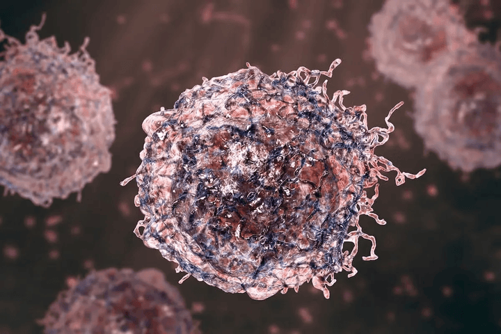 Beyond the Lump: Understanding Sarcoma Cancer